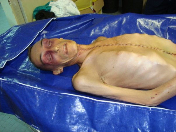 stefano-cucchi