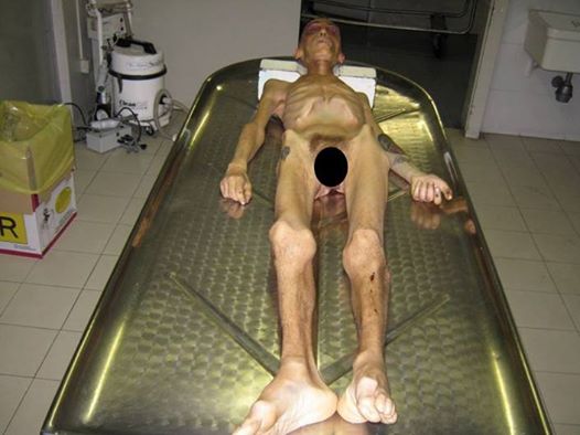stefano-cucchi
